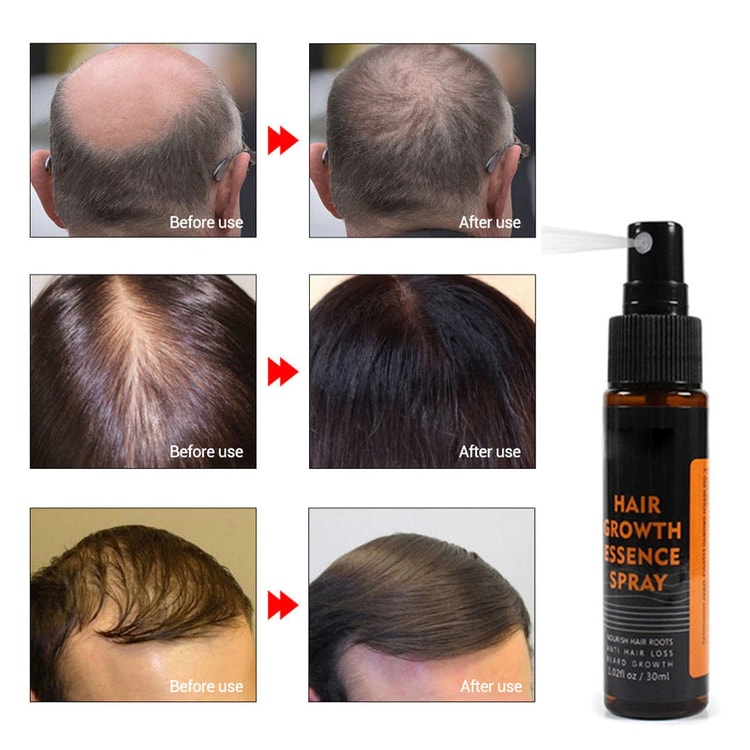 Herbal Hair Essence Spray