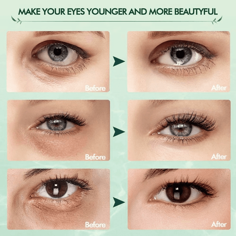 Essential Oil Under Eye Patches